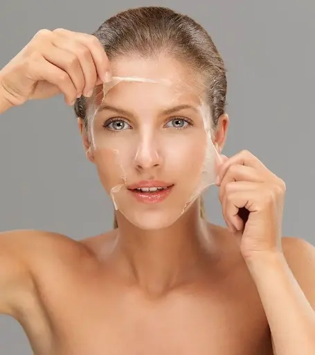 Peeling